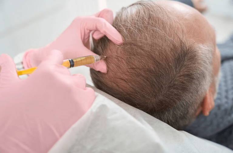 Does PRF Hair Treatment Work Equally for Men and Women?